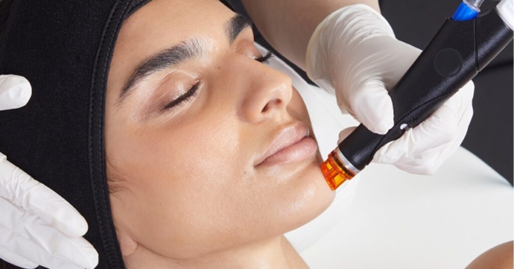 A woman receiving a Hydrafacial treatment at Brookhaven Med Spa.