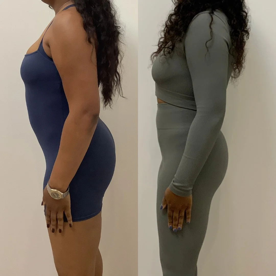 A before and after weight loss photo.