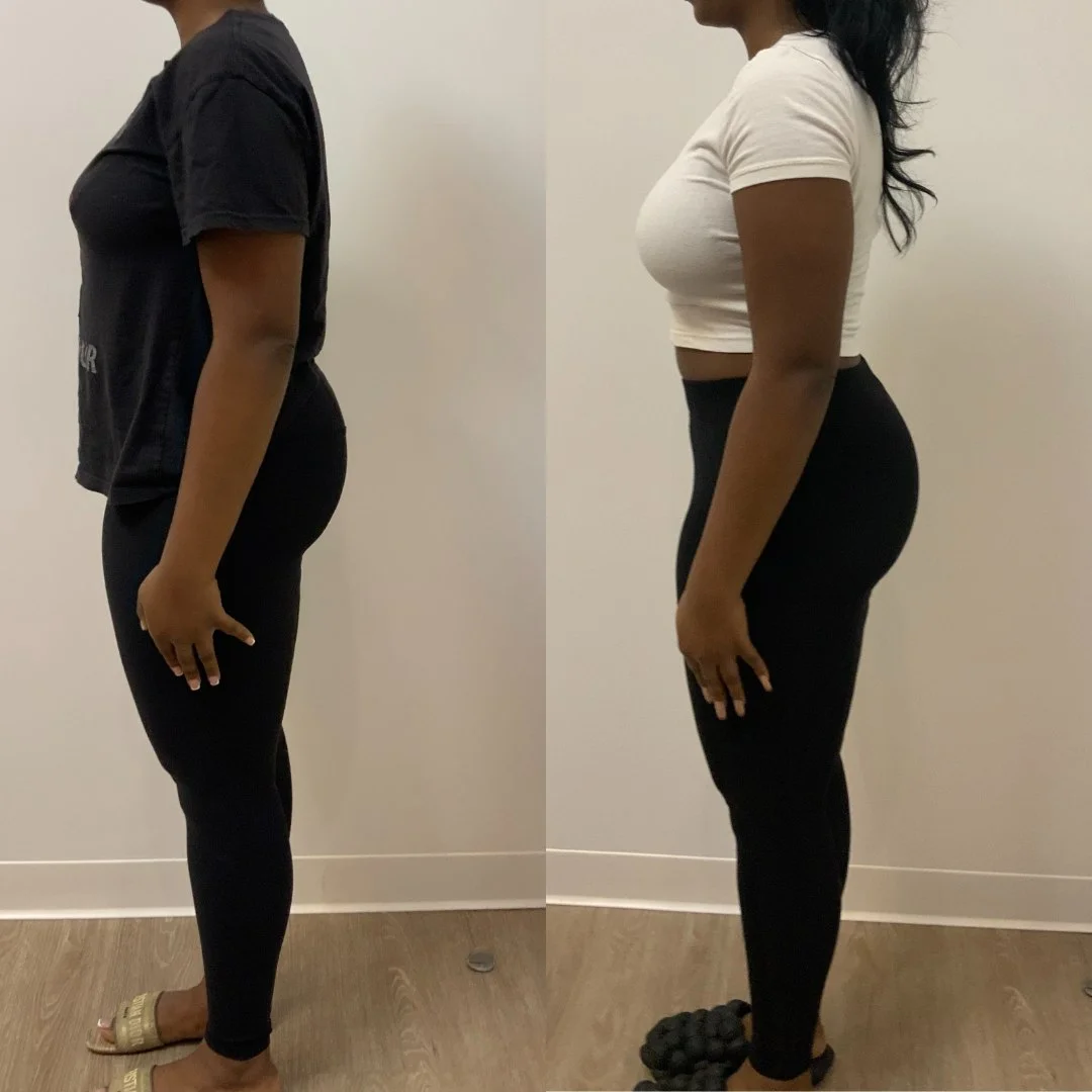 Skin Suite Medspa weight loss comparison photo before and after