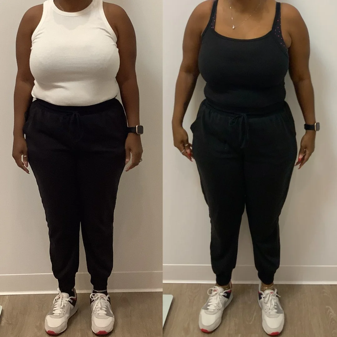 A weight loss comparison photo before and after