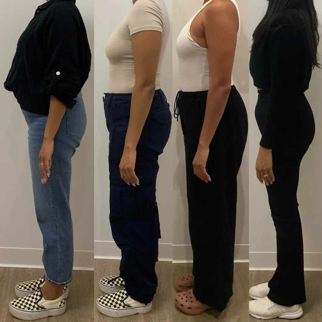 A weight loss comparison photo