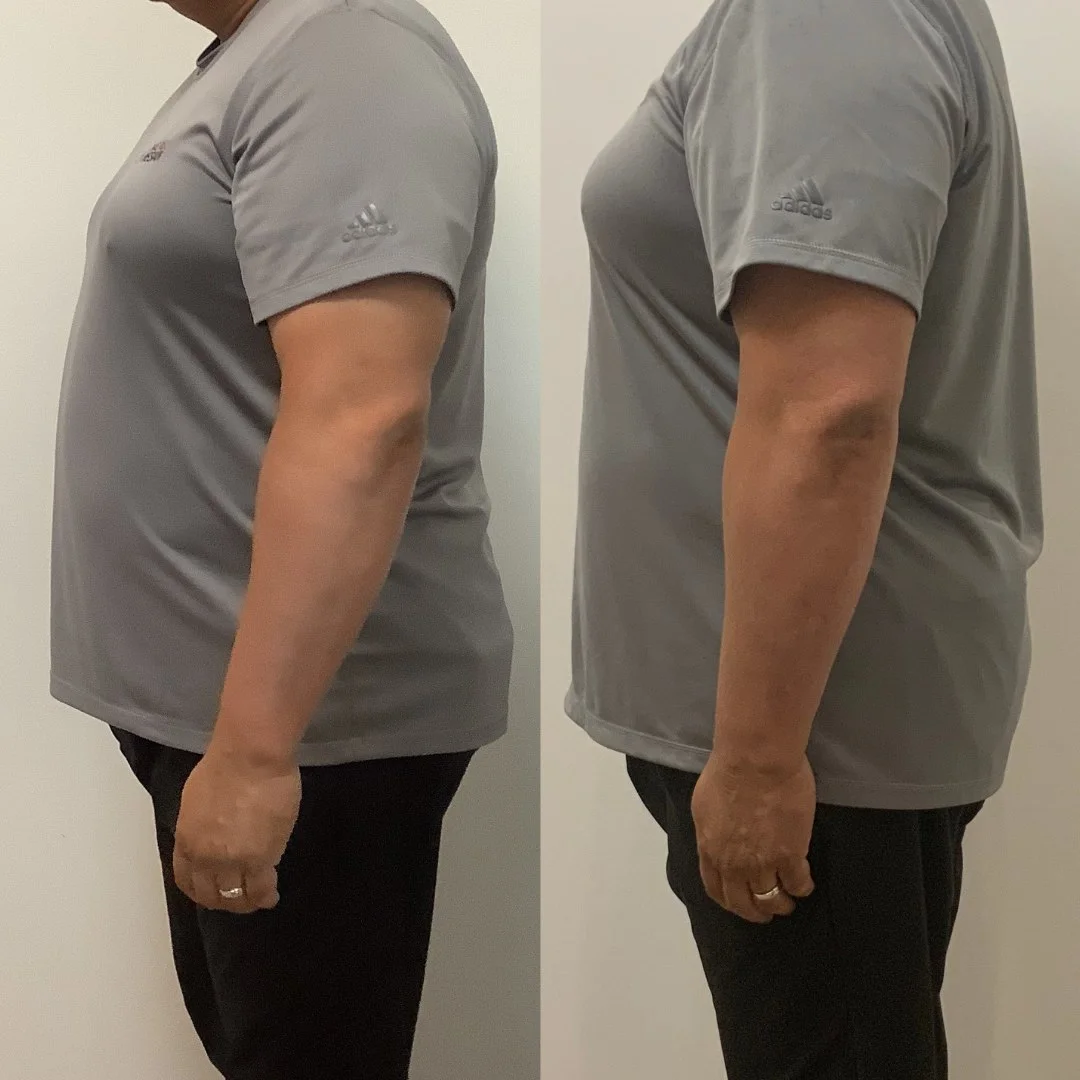 Before and after weight loss photo