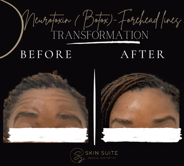 A before and after photo of a woman's eyebrows.