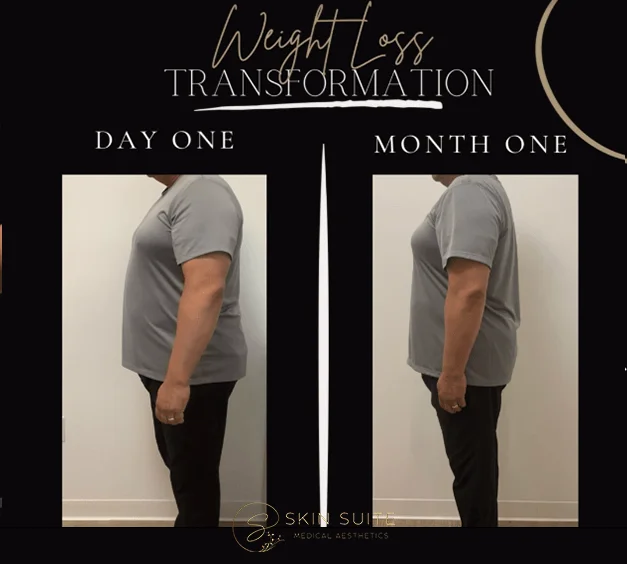 Weight loss transformation - day one - month one.