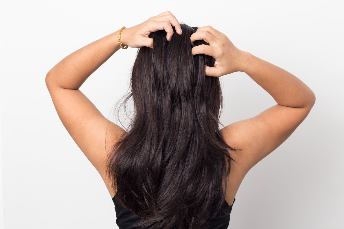 A woman with long hair undergoing hair restoration.