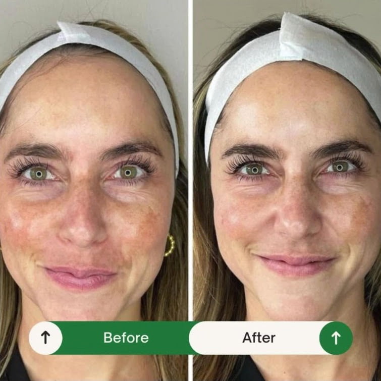 Before and after photos of a woman's face featuring promotions.