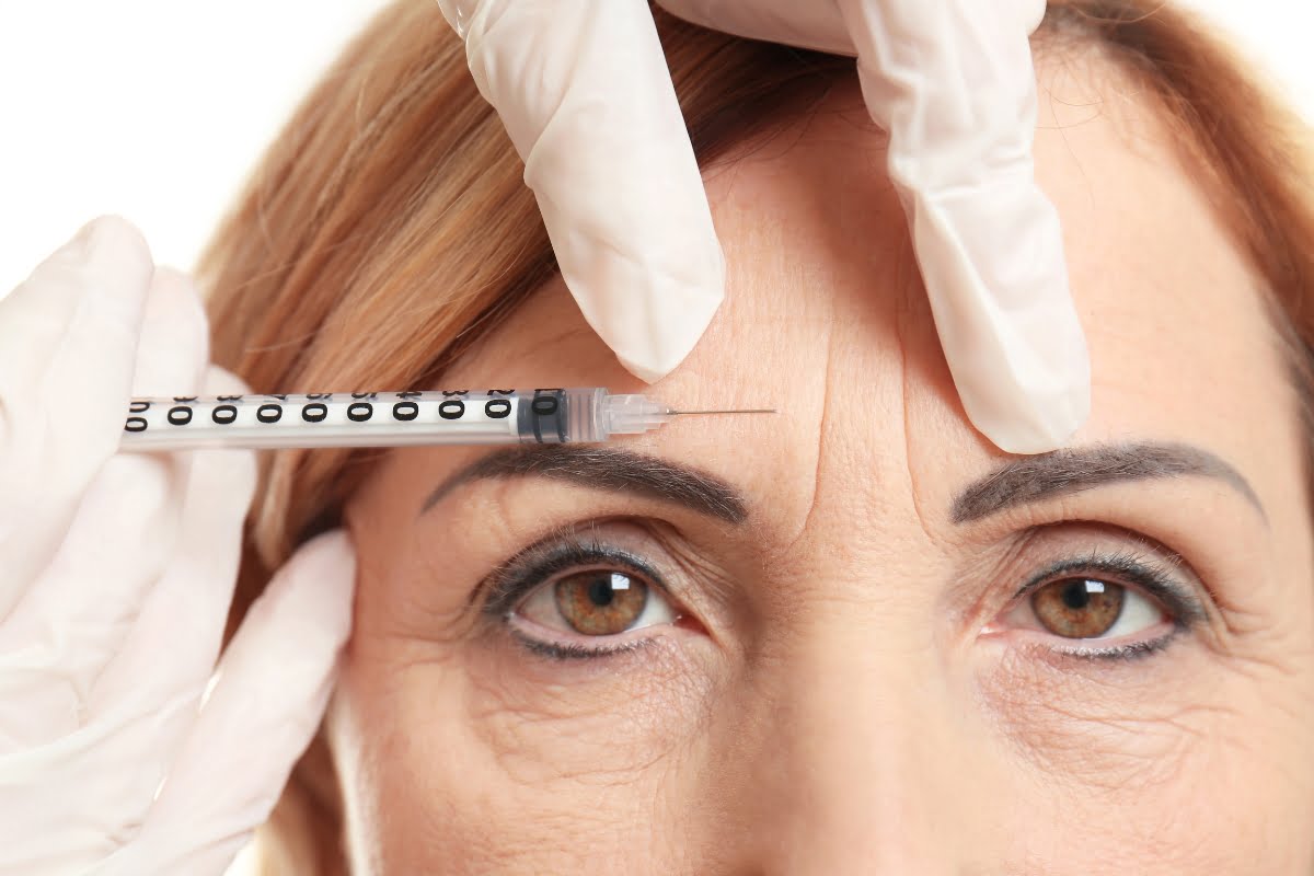 Cosmetic treatment: a professional administers a neurotoxin treatment, specifically a botox injection, to a woman's forehead.