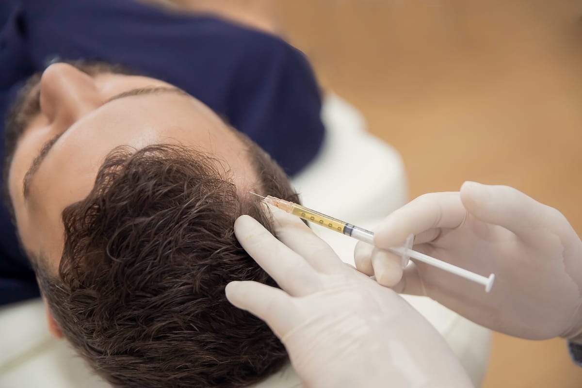 A man is lying down while a gloved professional administers PRP injections into his scalp.